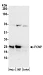 Detection of human PCNP by western blot.