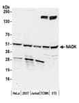 Detection of human and mouse NADK by western blot.