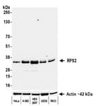Detection of human RPS2 by western blot.