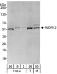 Detection of human and mouse WDR12 by western blot.