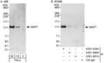 Detection of human MAP7 by western blot and immunoprecipitation.
