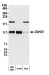 Detection of human DDHD1 by western blot.