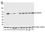Detection of mouse Vimentin by western blot.
