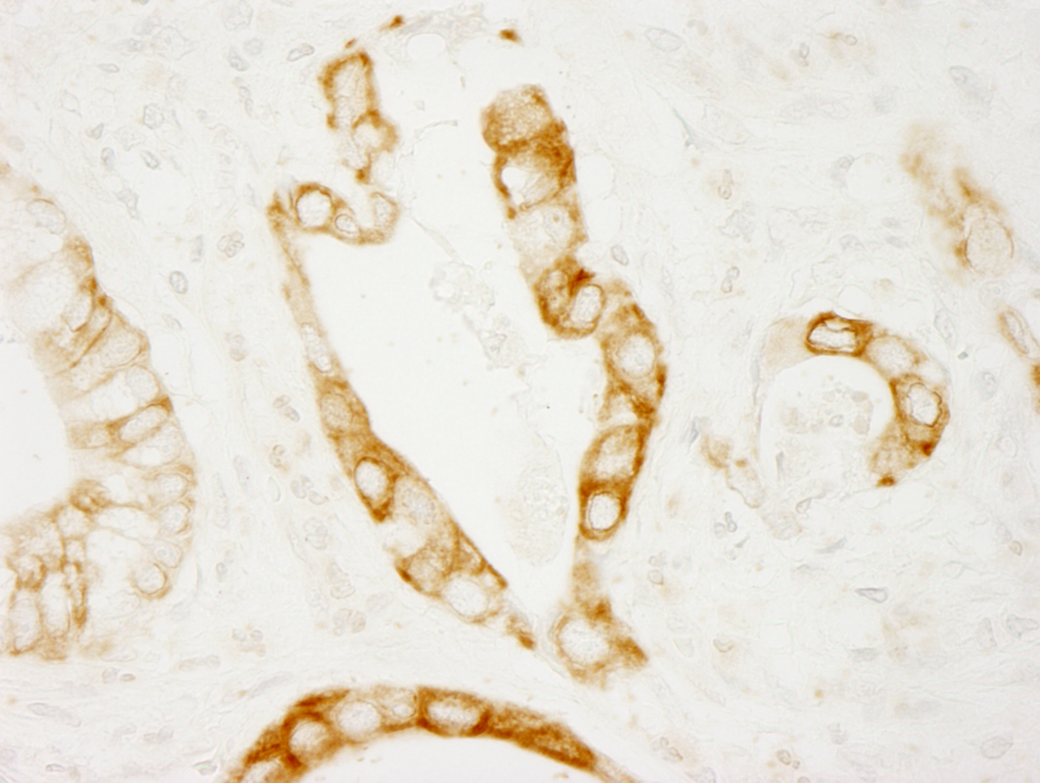 Rabbit anti-PKD2 IHC Antibody