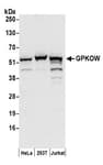 Detection of human GPKOW by western blot.