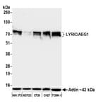 Detection of mouse LYRIC/AEG1 by western blot.