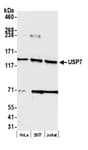 Detection of human USP7 by western blot.