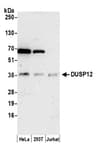 Detection of human DUSP12 by western blot.