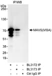 Detection of human MAVS/VISA by western blot of immunoprecipitates.
