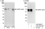 Detection of human CaMKK alpha by western blot and immunoprecipitation.