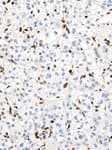 Detection of human TFE3 by immunohistochemistry.