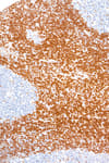 Detection of human p27 by immunohistochemistry.