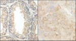 Detection of human and mouse BAD by immunohistochemistry.