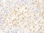 Detection of mouse DDX27 by immunohistochemistry.