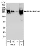 Detection of human BRIP1/BACH1 by western blot.