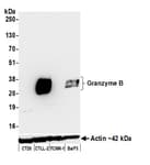 Detection of mouse Granzyme B by western blot.