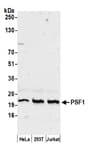 Detection of human PSF1 by western blot.