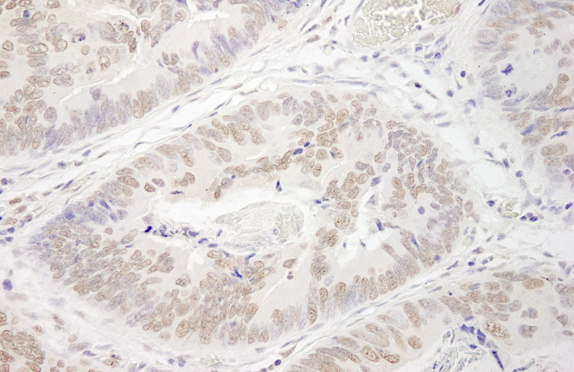 Rabbit anti-PRMT6 IHC Antibody