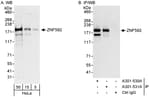 Detection of human ZNF592 by western blot and immunoprecipitation.