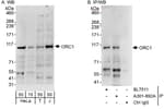 Detection of human ORC1 by western blot and immunoprecipitation.