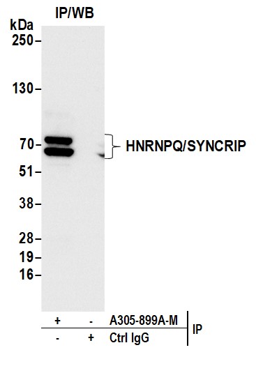 Detection of human HNRNPQ/SYNCRIP by western blot of immunoprecipitates.