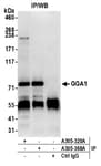 Detection of human GGA1 by western blot of immunoprecipitates.