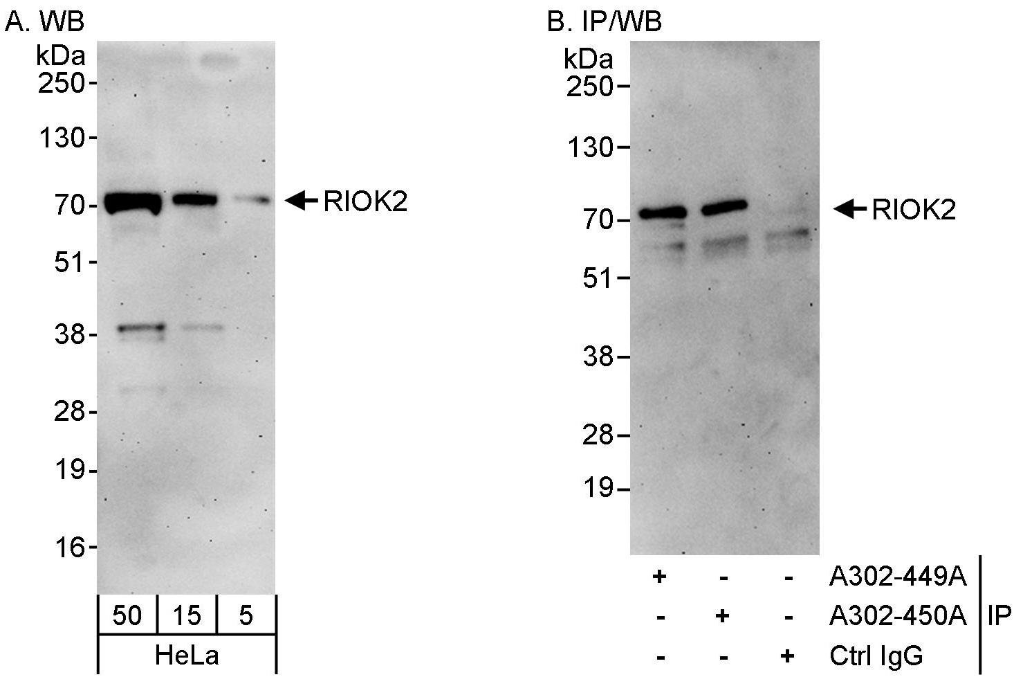 Detection of human RIOK2 by western blot and immunoprecipitation.