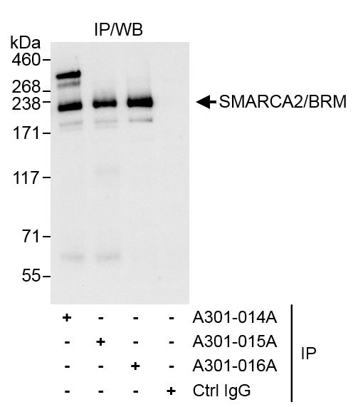 Detection of human SMARCA2/BRM by western blot of immunoprecipitates.