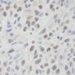 Detection of mouse DHX9 by immunohistochemistry.