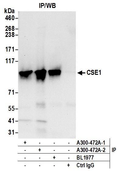 Detection of human CSE1 by western blot of immunoprecipitates.