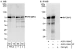 Detection of human IRF2BP2 by western blot and immunoprecipitation.