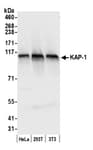 Detection of human and mouse KAP-1 by western blot.