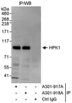 Detection of human HPK1 by western blot of immunoprecipitates.