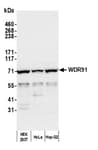 Detection of human WDR91 by western blot.
