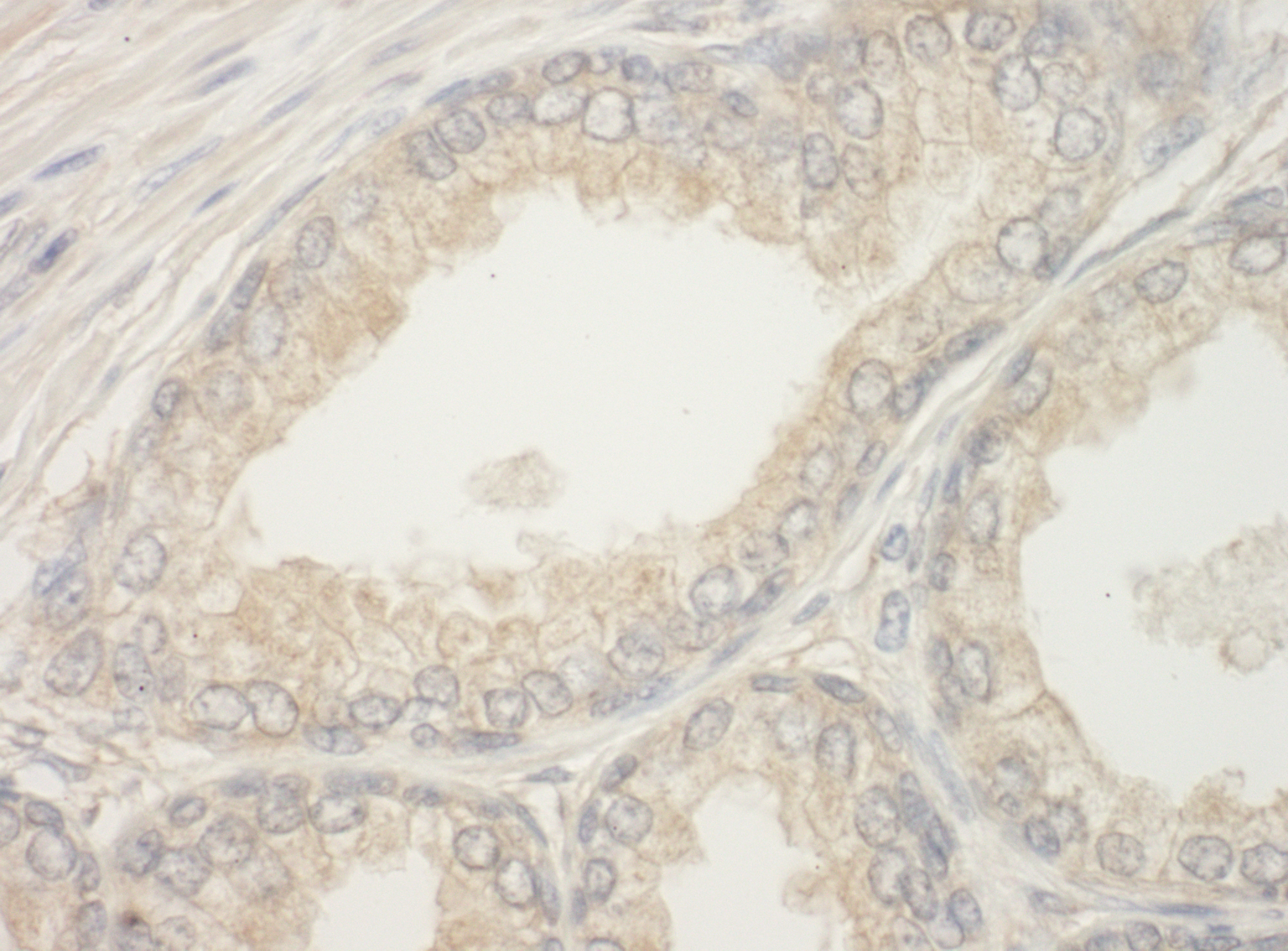 Rabbit anti-BAD IHC Antibody