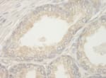 Detection of human BAD by immunohistochemistry.