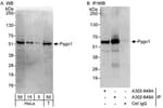 Detection of human Pygo1 by western blot and immunoprecipitation.