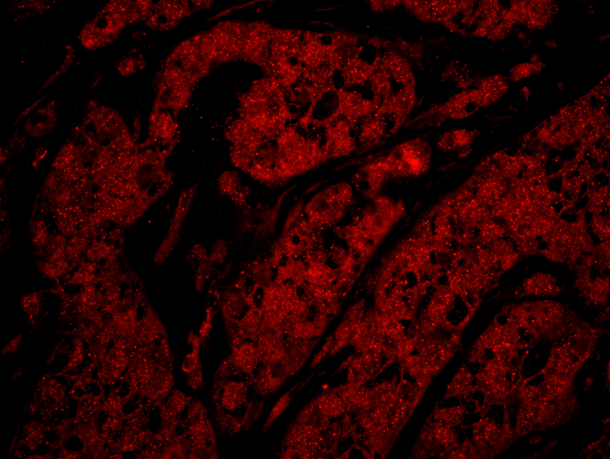 Detection of human Rad9 by IHC-IF.