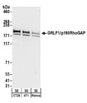 Detection of mouse GRLF1/p190RhoGAP by western blot.