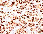 Detection of human Progesterone Receptor by immunohistochemistry.