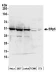 Detection of human ERp5 by western blot.
