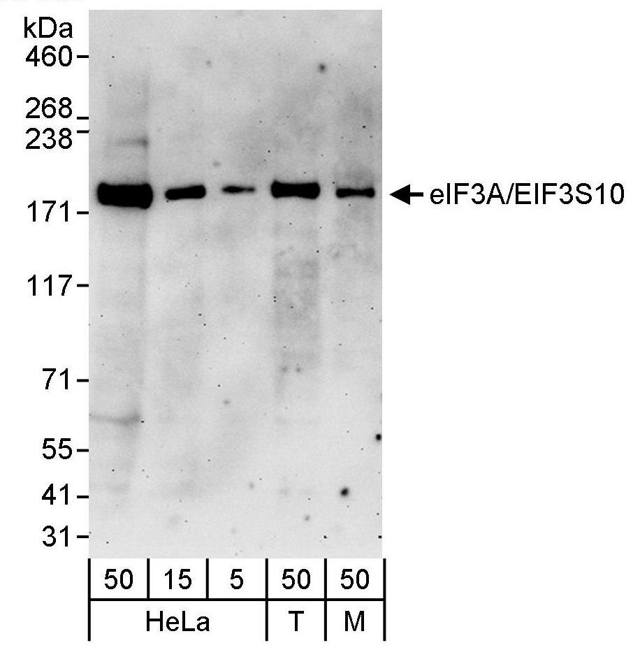 Detection of human and mouse eIF3A/EIF3S10 by western blot.