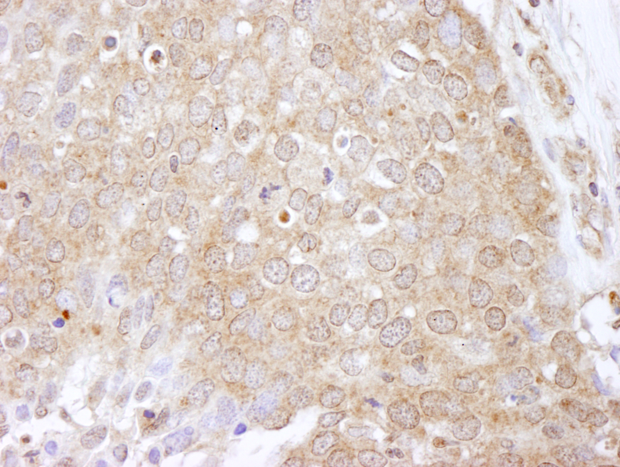 Rabbit anti-eEF2 Kinase IHC Antibody