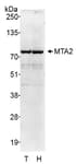 Detection of human MTA2 by western blot.