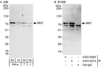 Detection of human MNT by western blot and immunoprecipitation.