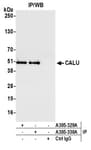 Detection of human CALU by western blot of immunoprecipitates.