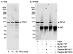 Detection of human TPX2 by western blot and immunoprecipitation.