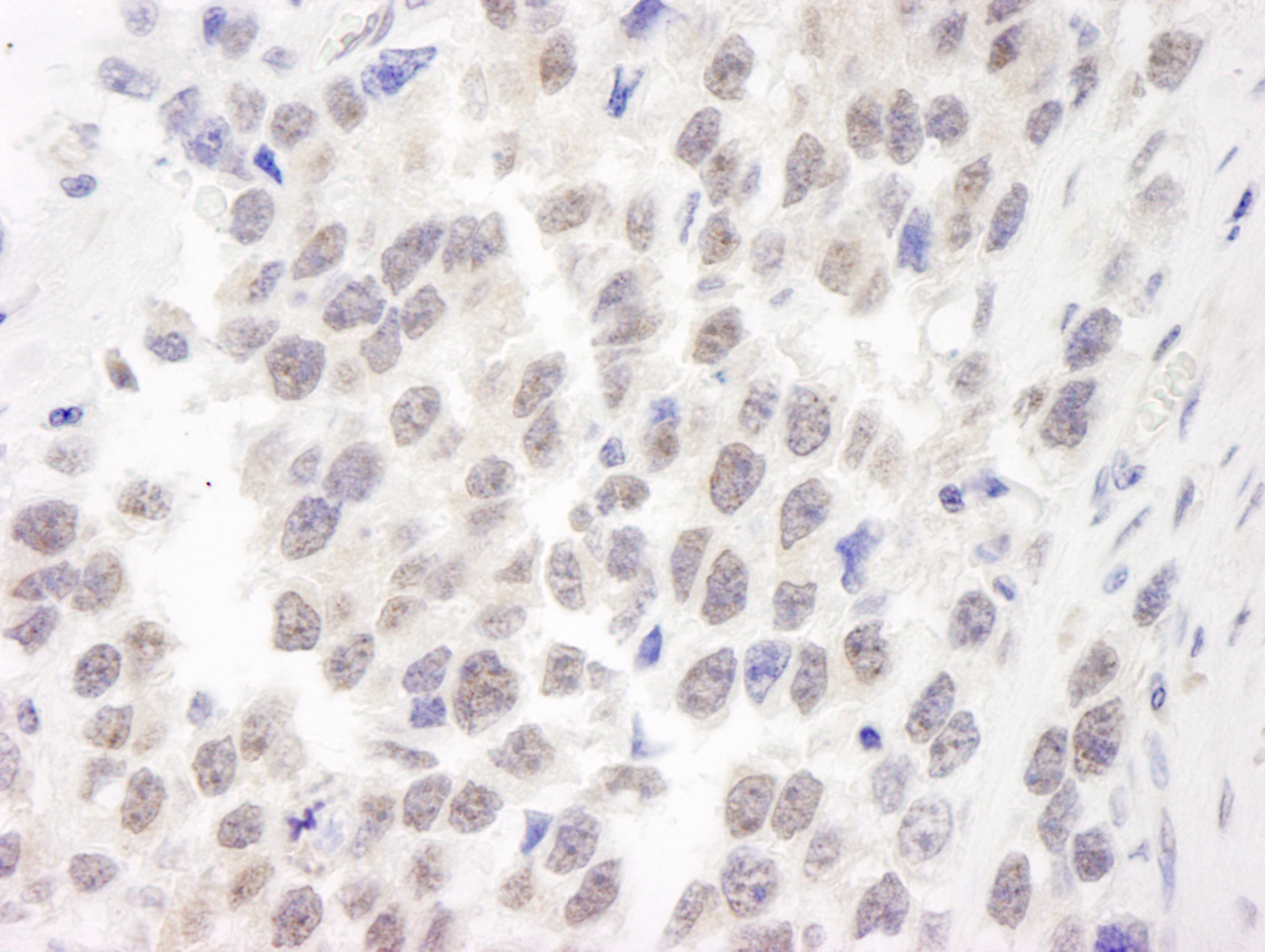 Rabbit anti-WRN IHC Antibody