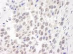 Detection of human WRN by immunohistochemistry.