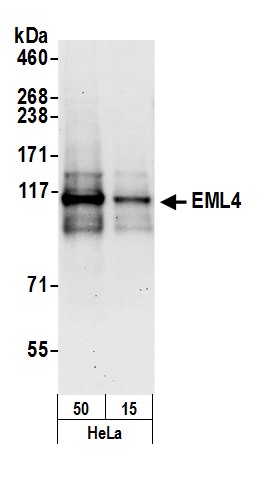 Detection of human EML4 by western blot.
